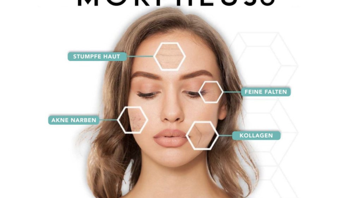 morpheus 8 vorher nachher